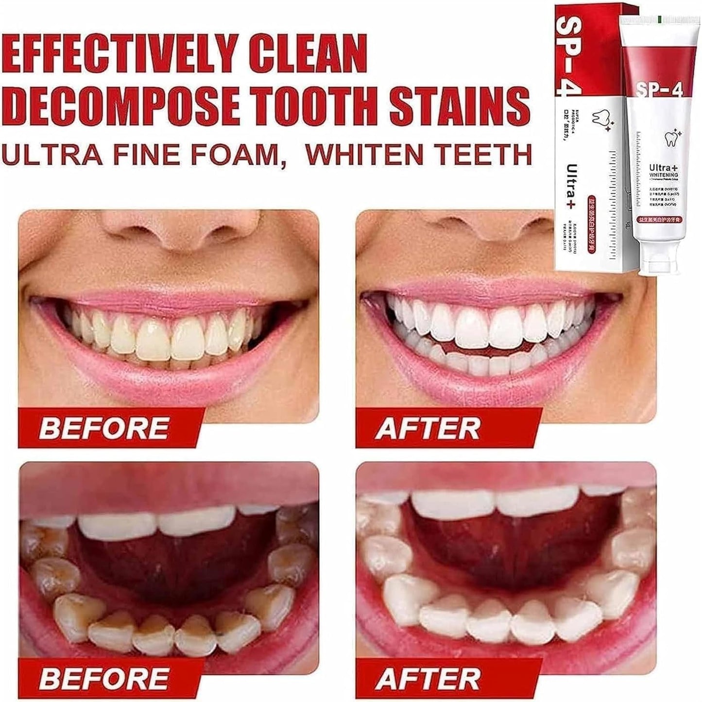 Yayashi Sp-4 Ultra Whitening Toothpaste Probiotic